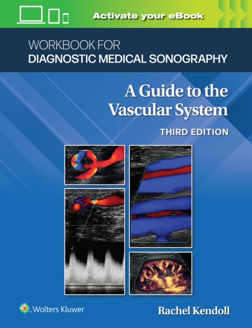 Workbook for Diagnostic Medical Sonography: The Vascular Systems, Paperback / softback Book