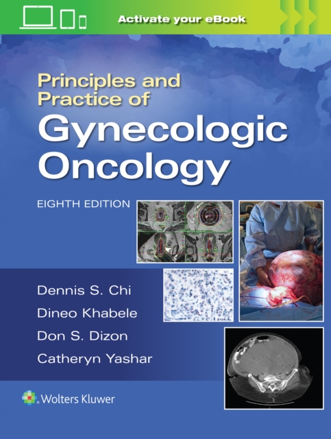 Principles and Practice of Gynecologic Oncology, Hardback Book