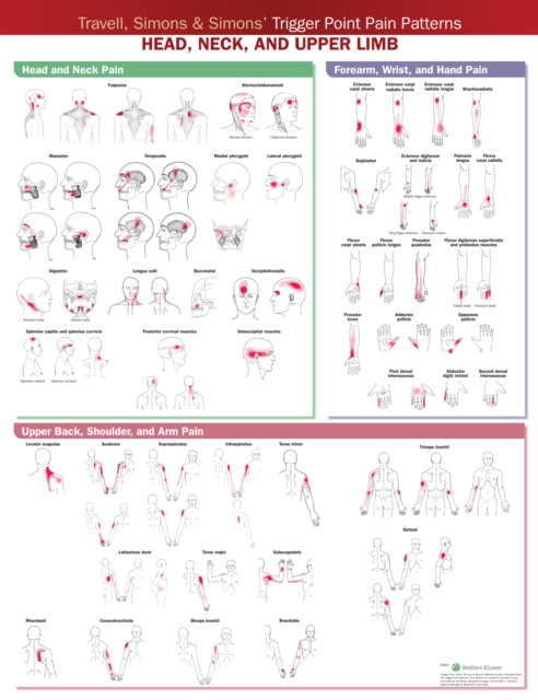Travell, Simons & Simons’ Trigger Point Pain Patterns Wall Chart : Head, Neck, and Upper Limb, Wallchart Book