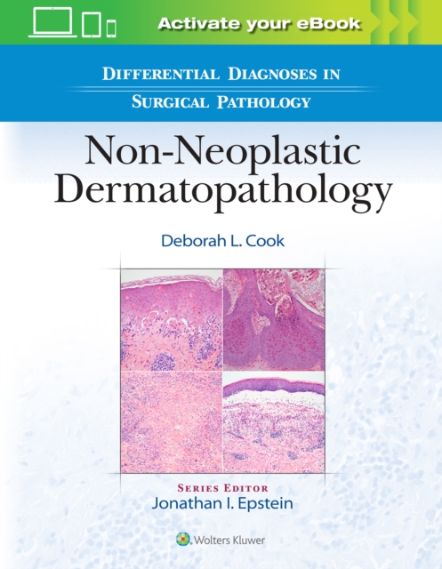 Differential Diagnoses in Surgical Pathology: Non-Neoplastic Dermatopathology, Hardback Book