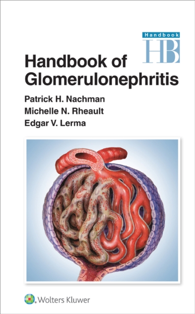 Handbook of Glomerulonephritis, EPUB eBook