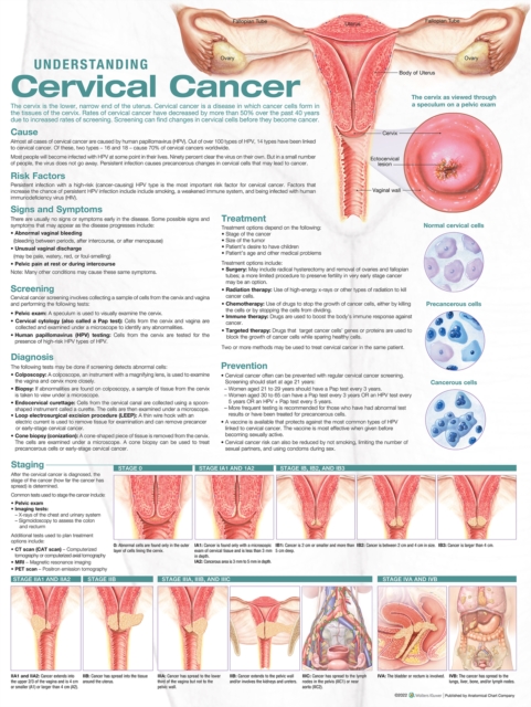 Understanding Cervical Cancer Anatomical Chart, Wallchart Book