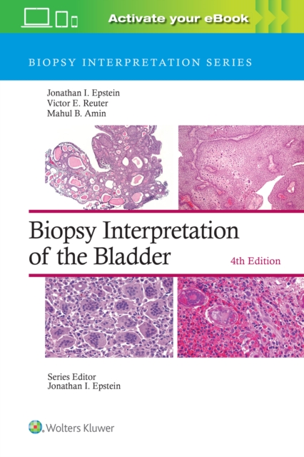 Biopsy Interpretation of the Bladder: Print + eBook with Multimedia, Hardback Book