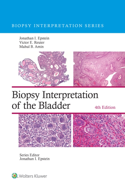Biopsy Interpretation of the Bladder, EPUB eBook