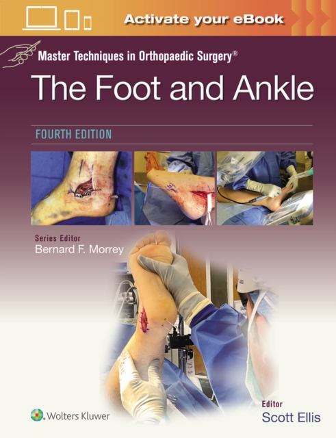 Master Techniques in Orthopaedic Surgery: The Foot and Ankle: Print + eBook with Multimedia, Hardback Book