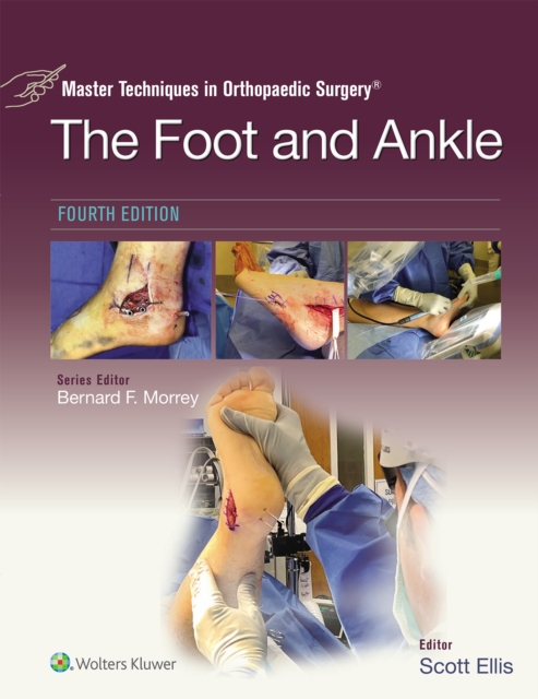 Master Techniques in Orthopaedic Surgery: The Foot and Ankle : eBook without Multimedia (Master Techniques in Orthopaedic Surgery), EPUB eBook
