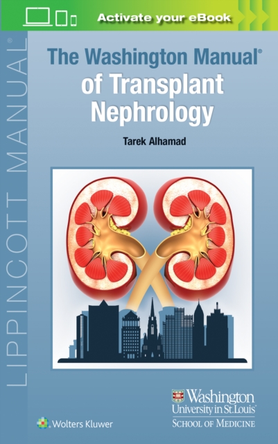 The Washington Manual of Transplant Nephrology, Paperback / softback Book