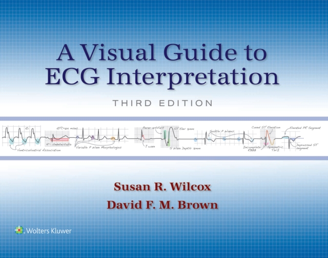 A Visual Guide to ECG Interpretation, EPUB eBook