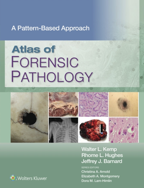Atlas of Forensic Pathology: A Pattern Based Approach : eBook without Multimedia, EPUB eBook