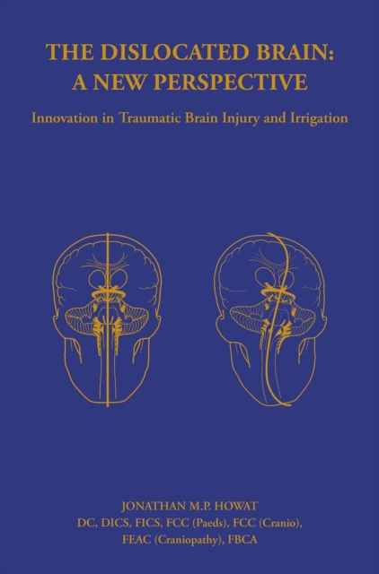 The Dislocated Brain : Innovation in Traumatic Brain Injury and Irrigation, EPUB eBook