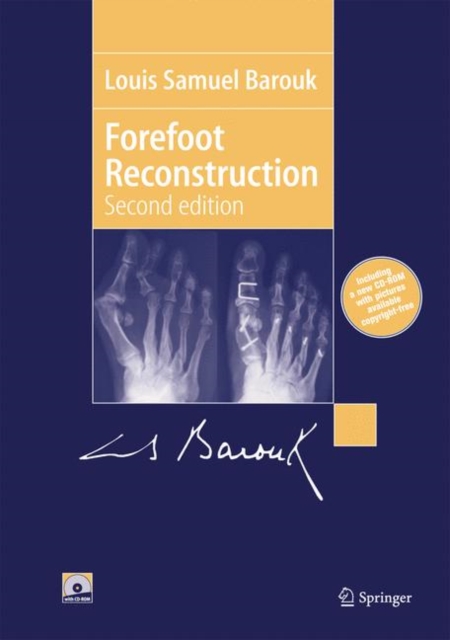 Forefoot Reconstruction, Paperback / softback Book