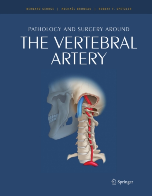 Pathology and surgery around the vertebral artery, PDF eBook