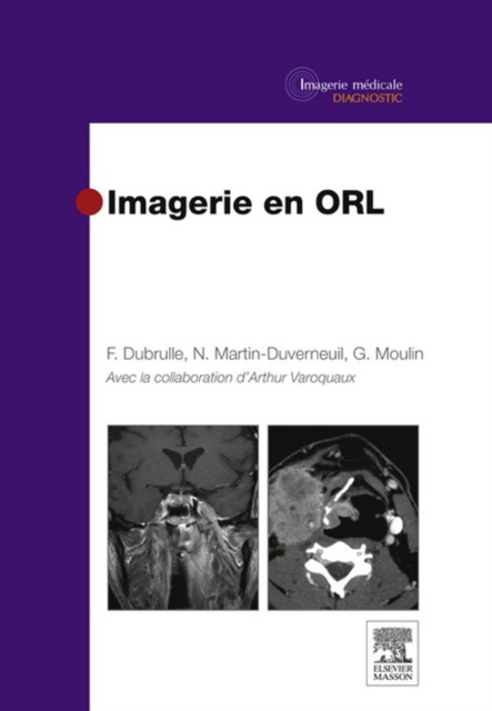 Imagerie en ORL, EPUB eBook
