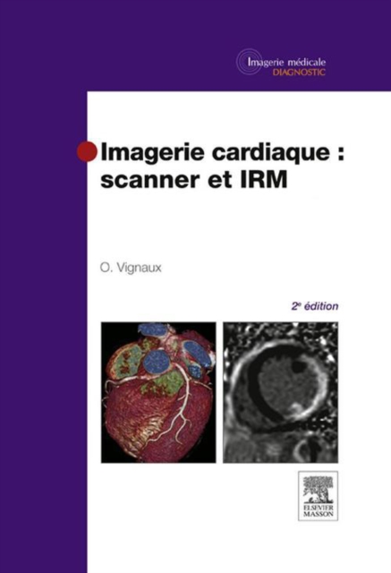 Imagerie cardiaque : scanner et IRM, EPUB eBook