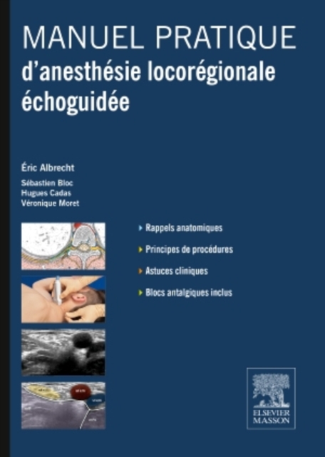 Manuel pratique d'anesthesie locoregionale echoguidee, EPUB eBook
