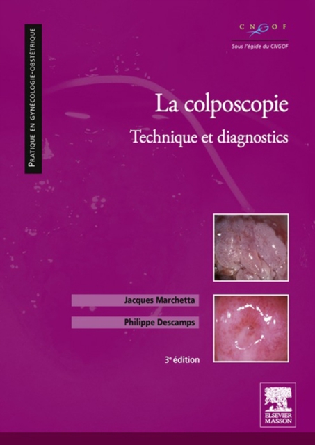 La colposcopie : Technique et diagnostics, EPUB eBook