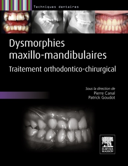 Dysmorphies maxillo-mandibulaires : Traitement orthodontico-chirurgical, EPUB eBook