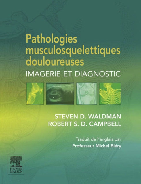 Pathologies musculosquelettiques douloureuses : Imagerie et diagnostic, EPUB eBook