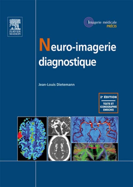Neuro-imagerie diagnostique, EPUB eBook