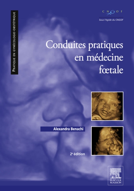 Conduites pratiques en medecine foetale, EPUB eBook