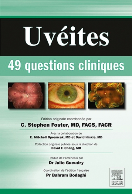 Uveites : 49 questions cliniques, EPUB eBook