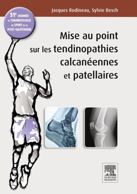 Mise au point sur les tendinopathies calcaneennes et patellaires : 31e journee de traumatologie du sport de la Pitie, EPUB eBook