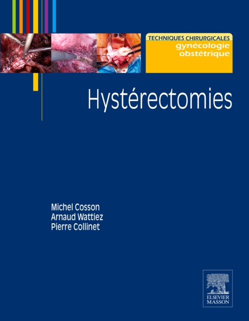 Hysterectomies, EPUB eBook