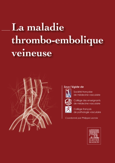 La maladie thrombo-embolique veineuse, EPUB eBook