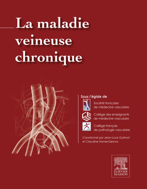 La maladie veineuse chronique, EPUB eBook