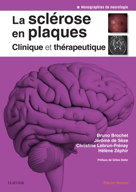 La sclerose en plaques - Clinique et therapeutique, EPUB eBook