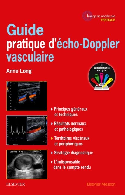 Guide pratique d'echo-Doppler vasculaire, PDF eBook