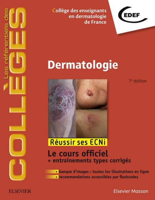 Dermatologie : Reussir les ECNi, EPUB eBook