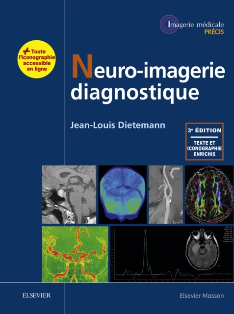 Neuro-imagerie diagnostique, EPUB eBook