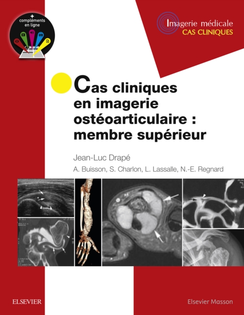 Cas cliniques en imagerie osteoarticulaire : membre superieur, EPUB eBook