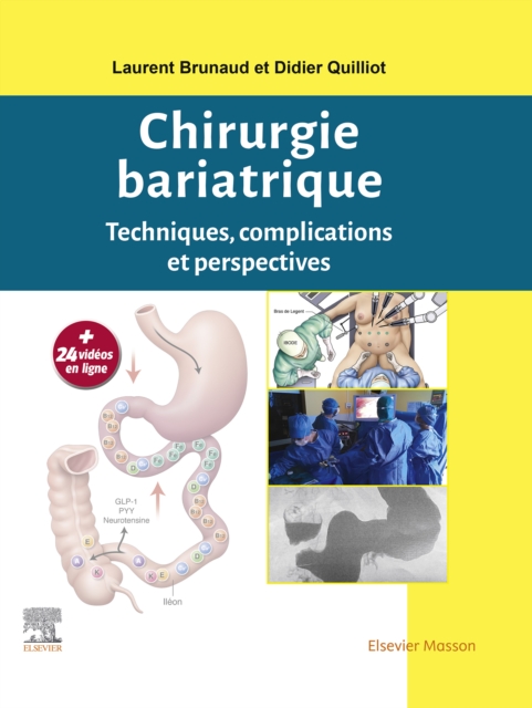 Chirurgie bariatrique : Techniques, complications et perspectives, EPUB eBook