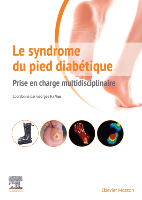 Le syndrome du pied diabetique : Prise en charge multidisciplinaire, EPUB eBook