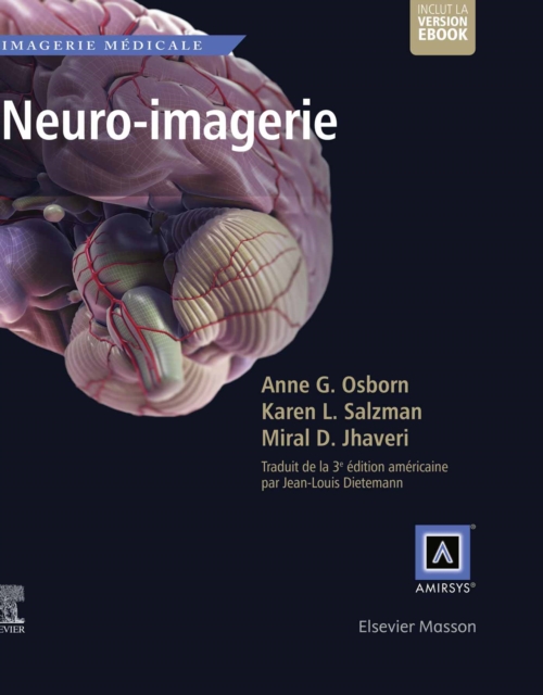 Neuro-imagerie, EPUB eBook