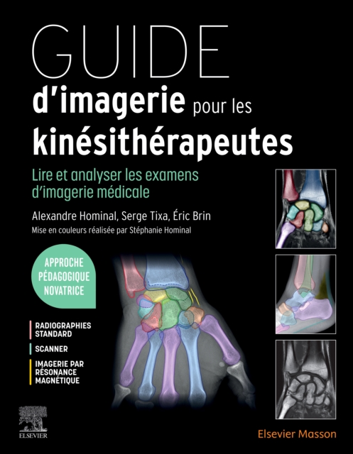 Guide d'imagerie pour les kinesitherapeutes : Lire et analyser les examens d'imagerie medicale, EPUB eBook