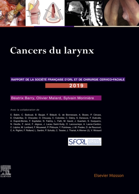 Cancers du larynx : Rapport SFORL 2019, EPUB eBook