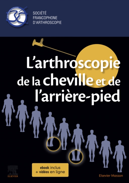 L'arthroscopie de la cheville et de l'arriere-pied, EPUB eBook