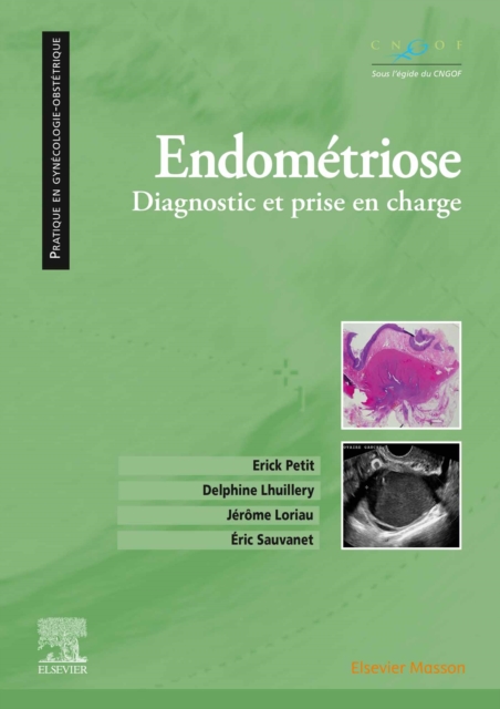 Endometriose : Diagnostic et prise en charge, EPUB eBook