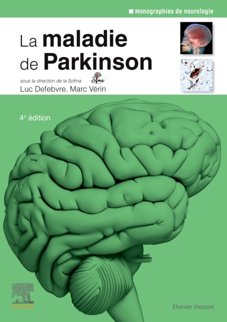 La maladie de Parkinson, EPUB eBook