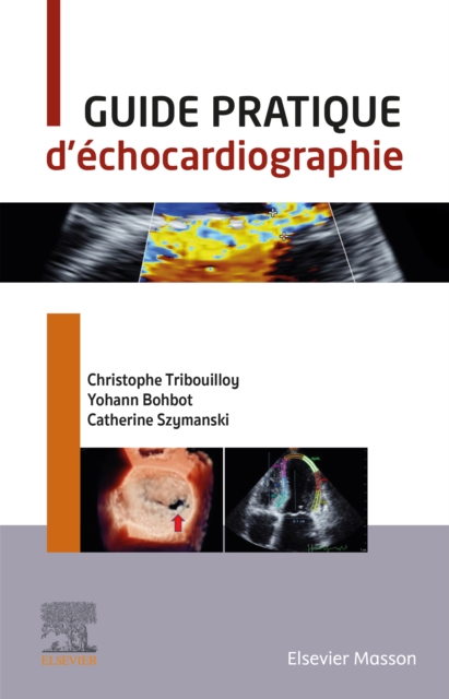 Guide pratique d'echocardiographie, EPUB eBook