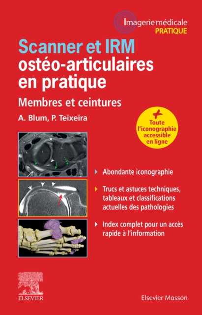 Scanner et IRM osteo-articulaires en pratique : Membres et ceintures, EPUB eBook