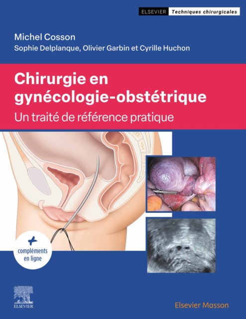 Chirurgie en gynecologie-obstetrique : Traite de reference pratique, EPUB eBook