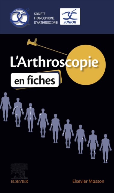 L'Arthroscopie en fiches, EPUB eBook
