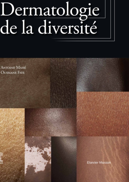 Dermatologie de la diversite, EPUB eBook