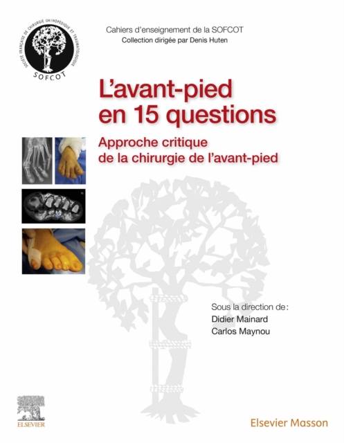 L'avant-pied en 15 questions : Approche critique de la chirurgie de l'avant-pied, EPUB eBook