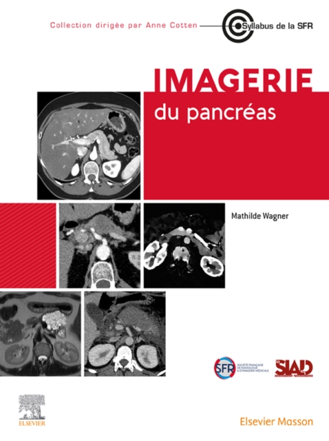 Imagerie du pancreas, EPUB eBook