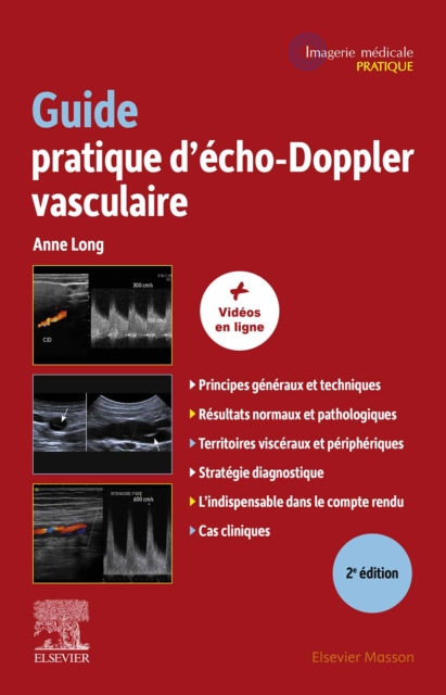 Guide pratique d'echo-Doppler vasculaire, EPUB eBook